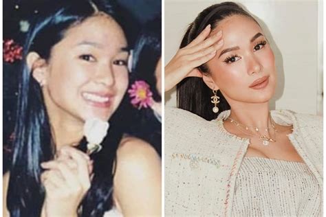 heart evangelista before and after.